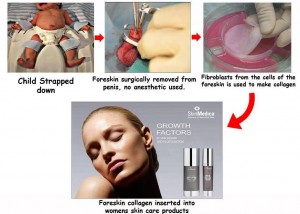The Process of foreskin harvesting for cosmetics